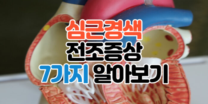 심근경색 전조증상 7가지 알아보기 관련 썸네일